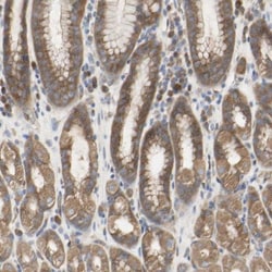 TTMP Antibody, Novus Biologicals 0.1mL; Unlabeled:Antibodies, Polyclonal